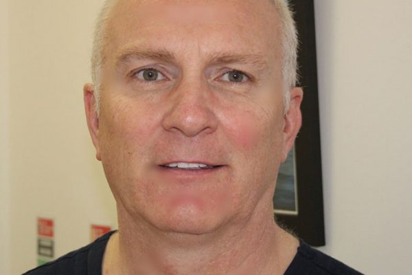 Dr. Bernard Murphy, BDS NUI Dental Surgeon